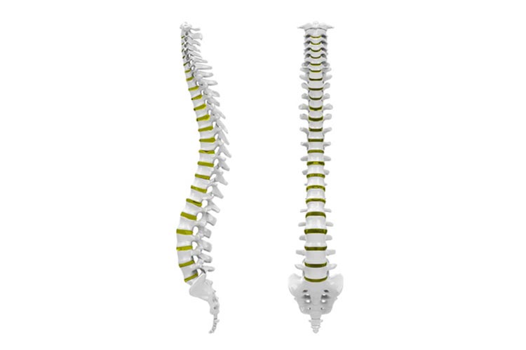 脊椎脊髄疾患イメージ